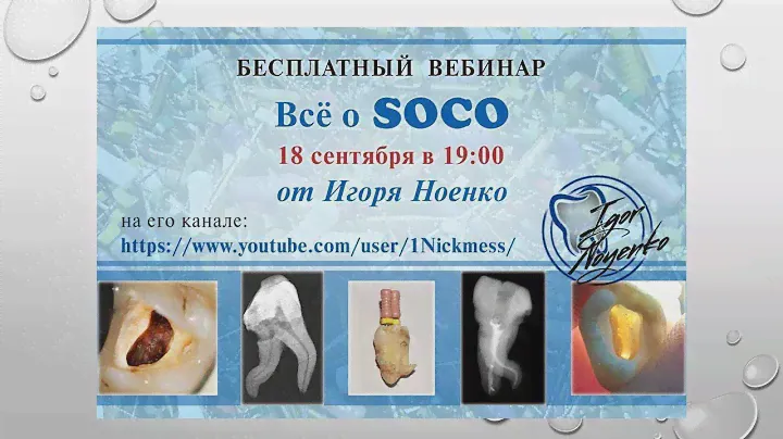 Вебинар на тему возможностей файлов Соко в сложных каналах.